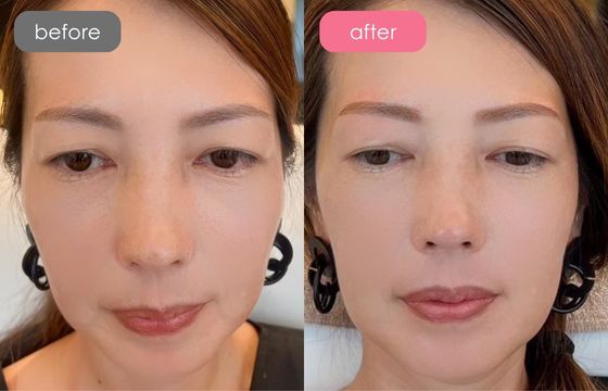 眉アートメイク-116 03