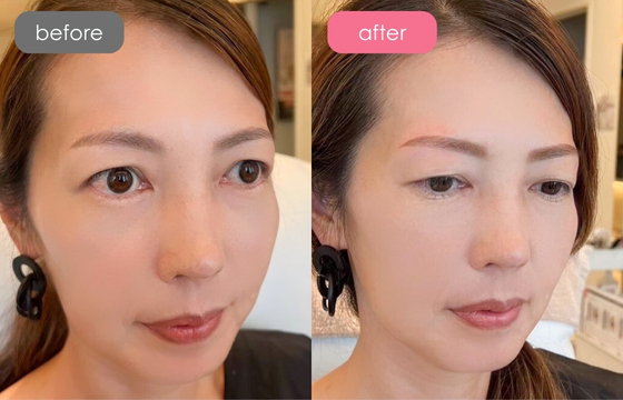 眉アートメイク-116 02