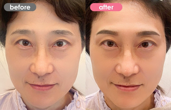 眉アートメイク-118