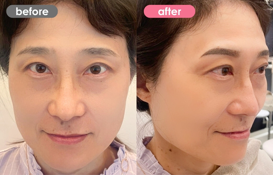 眉アートメイク-118 02