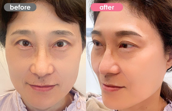 眉アートメイク-118 03