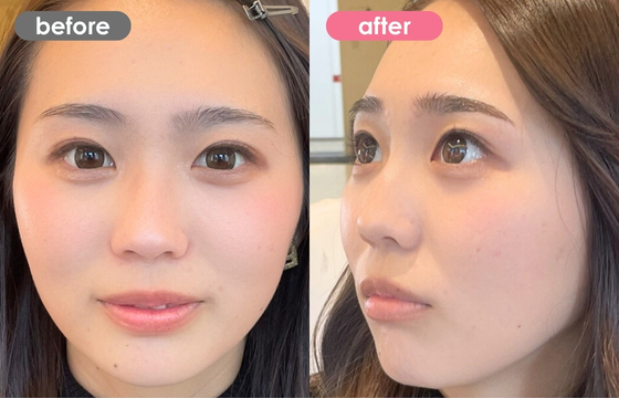 眉アートメイク-123 02