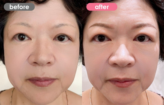 眉アートメイク-124