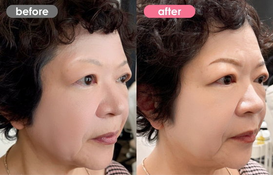 眉アートメイク-124 02