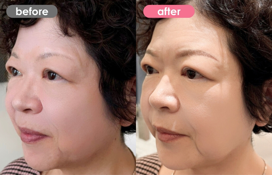 眉アートメイク-124 03