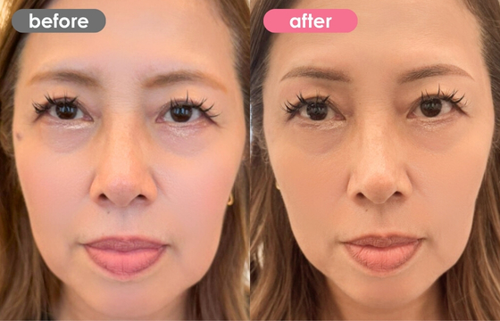 眉アートメイク-125