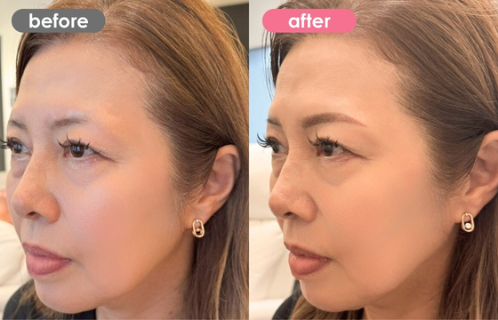 眉アートメイク-125 02