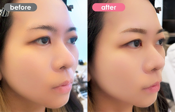 眉アートメイク-126 02