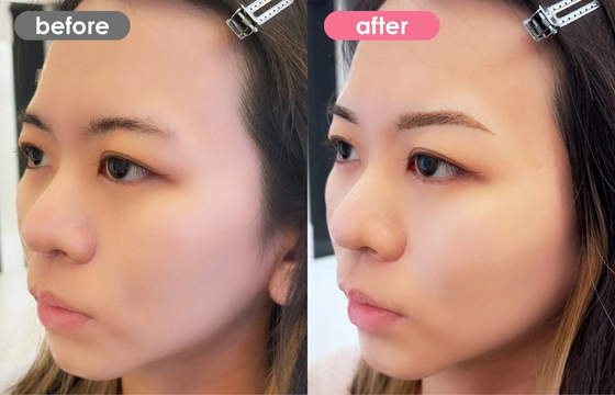 眉アートメイク-126 03