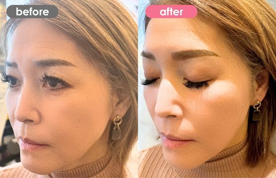 眉アートメイク-128 02