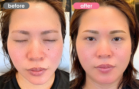 眉アートメイク-129 02