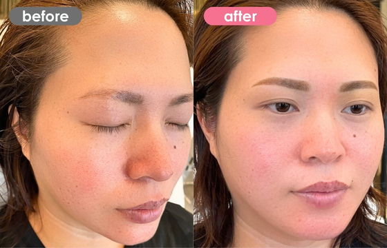 眉アートメイク-129 03