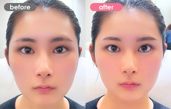 眉アートメイク-131