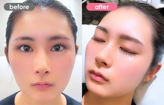 眉アートメイク-131 02