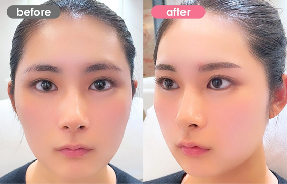 眉アートメイク-131 03