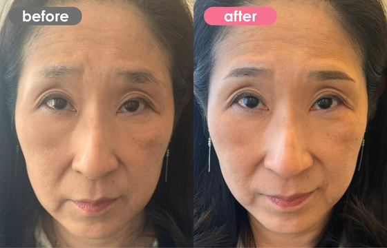 眉アートメイク-132