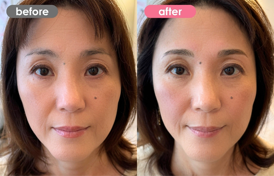 眉アートメイク-133