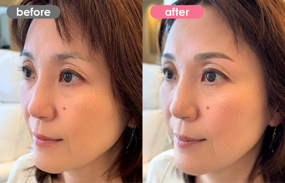 眉アートメイク-133 02