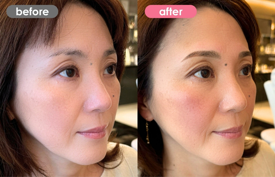 眉アートメイク-133 03