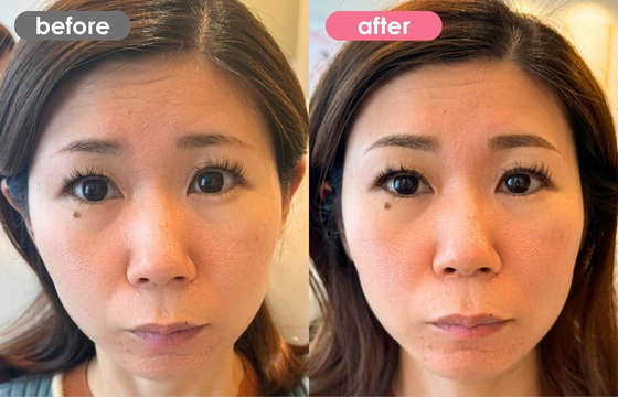 眉アートメイク-134 02