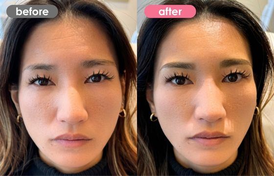 眉アートメイク-135