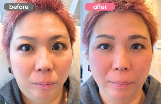 眉アートメイク-137