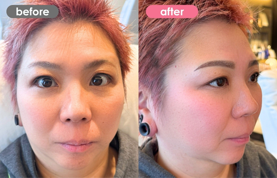 眉アートメイク-137 02