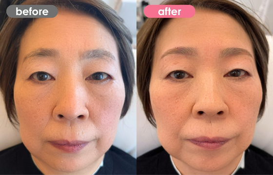 眉アートメイク-139 02