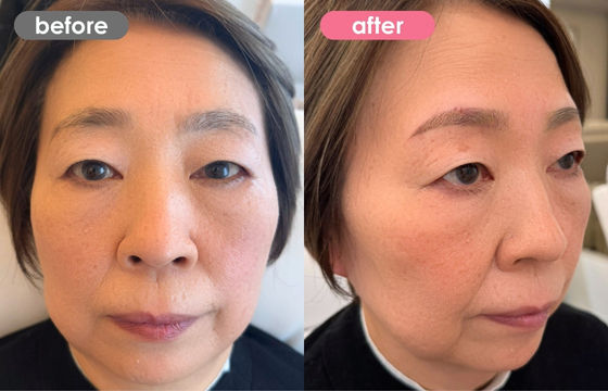 眉アートメイク-139