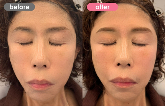 眉アートメイク-140 02