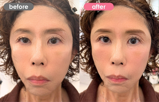 眉アートメイク-140