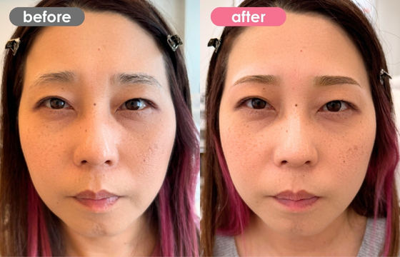 眉アートメイク-141 02