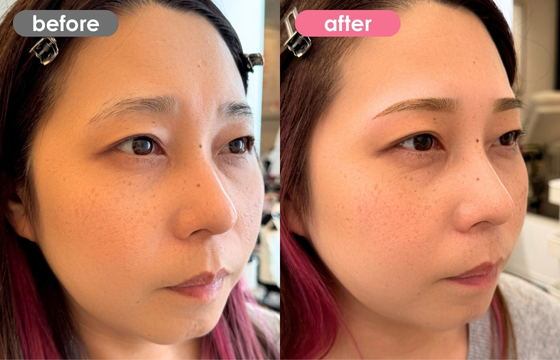 眉アートメイク-141