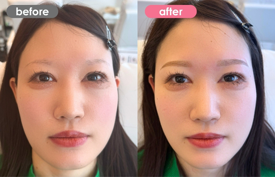 眉アートメイク-142 02