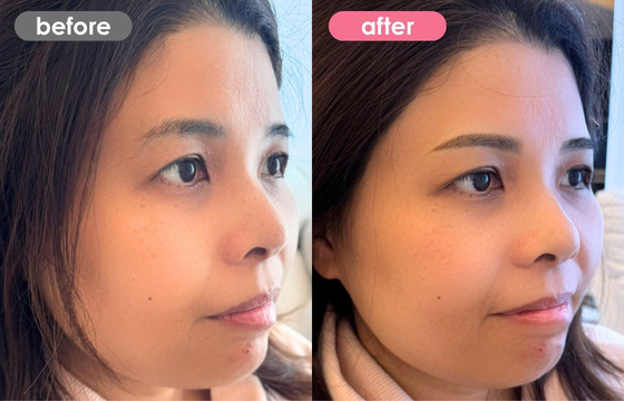 眉アートメイク-143 02