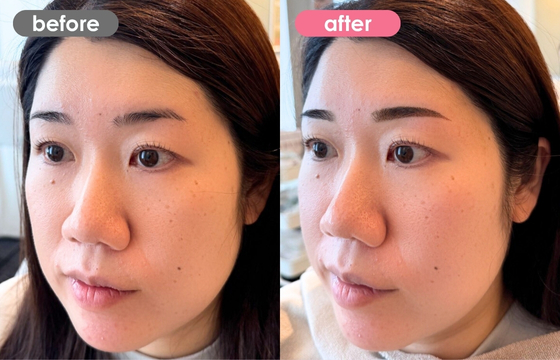 眉アートメイク-144 02