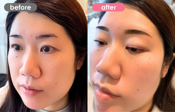 眉アートメイク-144 03