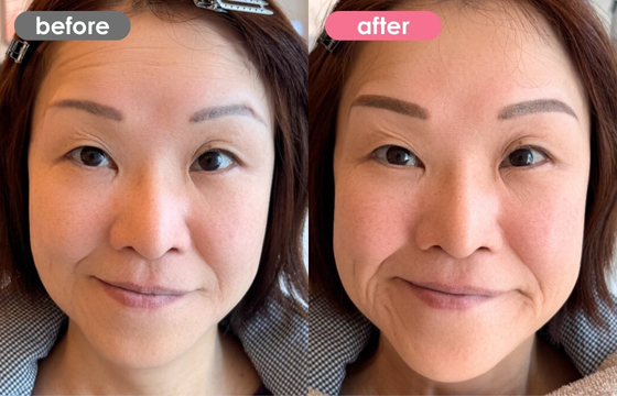 眉アートメイク-145