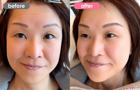 眉アートメイク-145 02