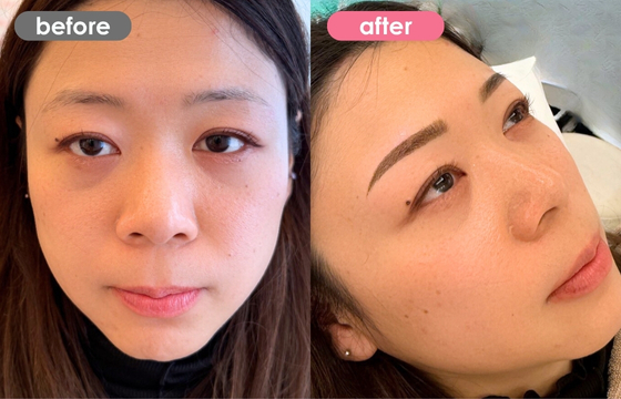 眉アートメイク-146 02