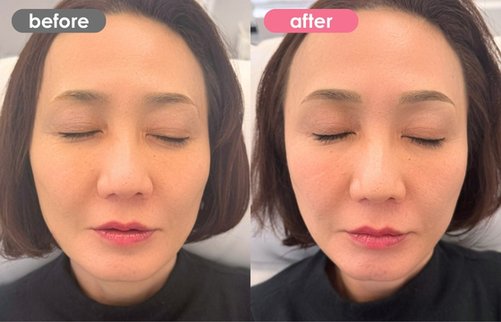 眉アートメイク-148 02