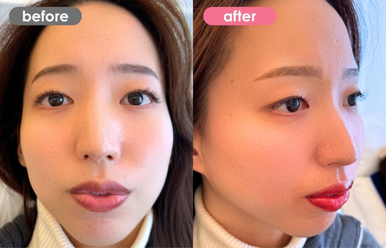 眉アートメイク-149 02