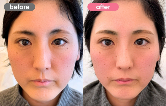 眉アートメイク-150