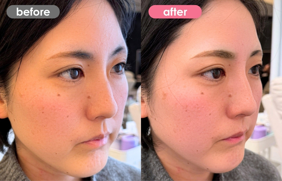 眉アートメイク-150 02