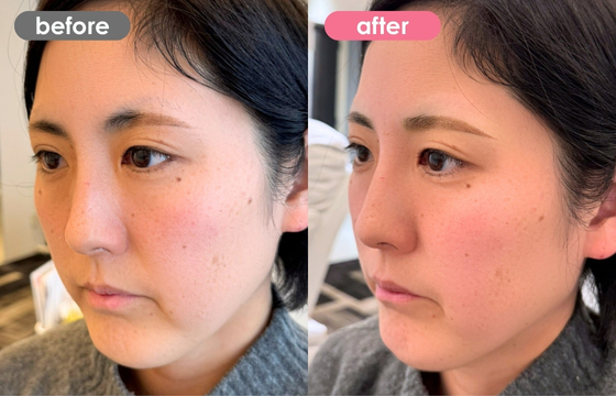 眉アートメイク-150 03