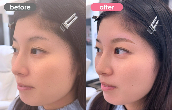 眉アートメイク-151 02