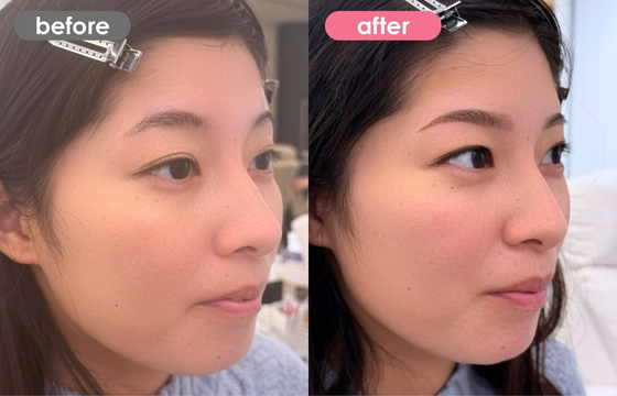 眉アートメイク-151 03