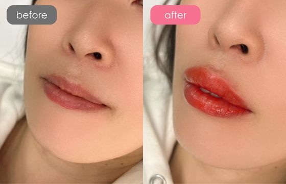 唇アートメイク-01