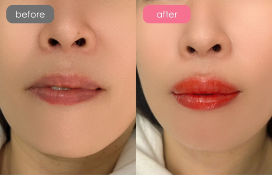 唇アートメイク-01 02