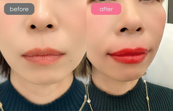 唇アートメイク-02